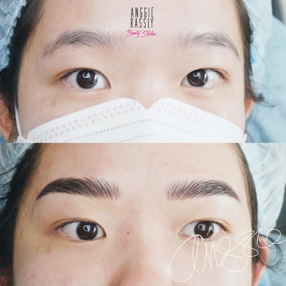 Before after HD Brows by Anggie Rassly
