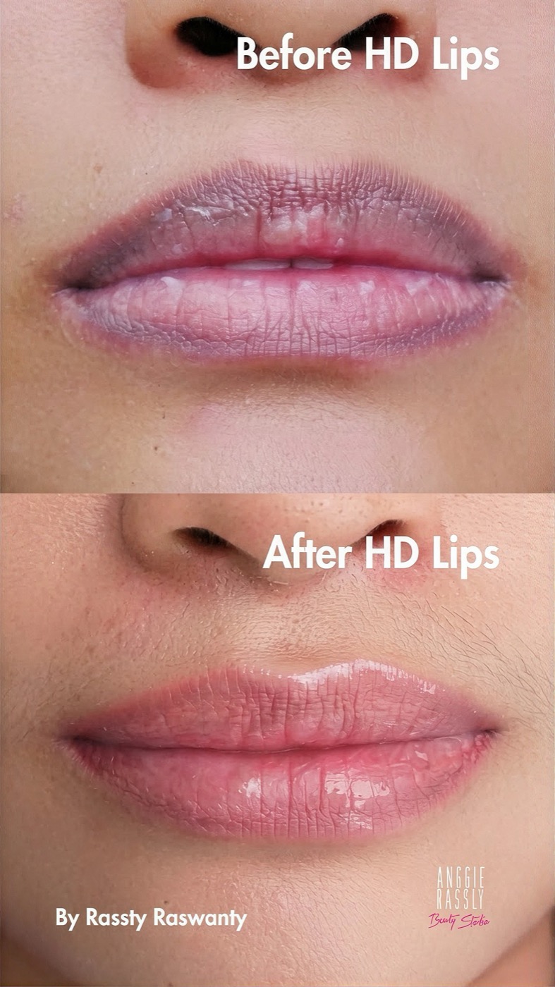 HD Lips · by Rassty Raswanty