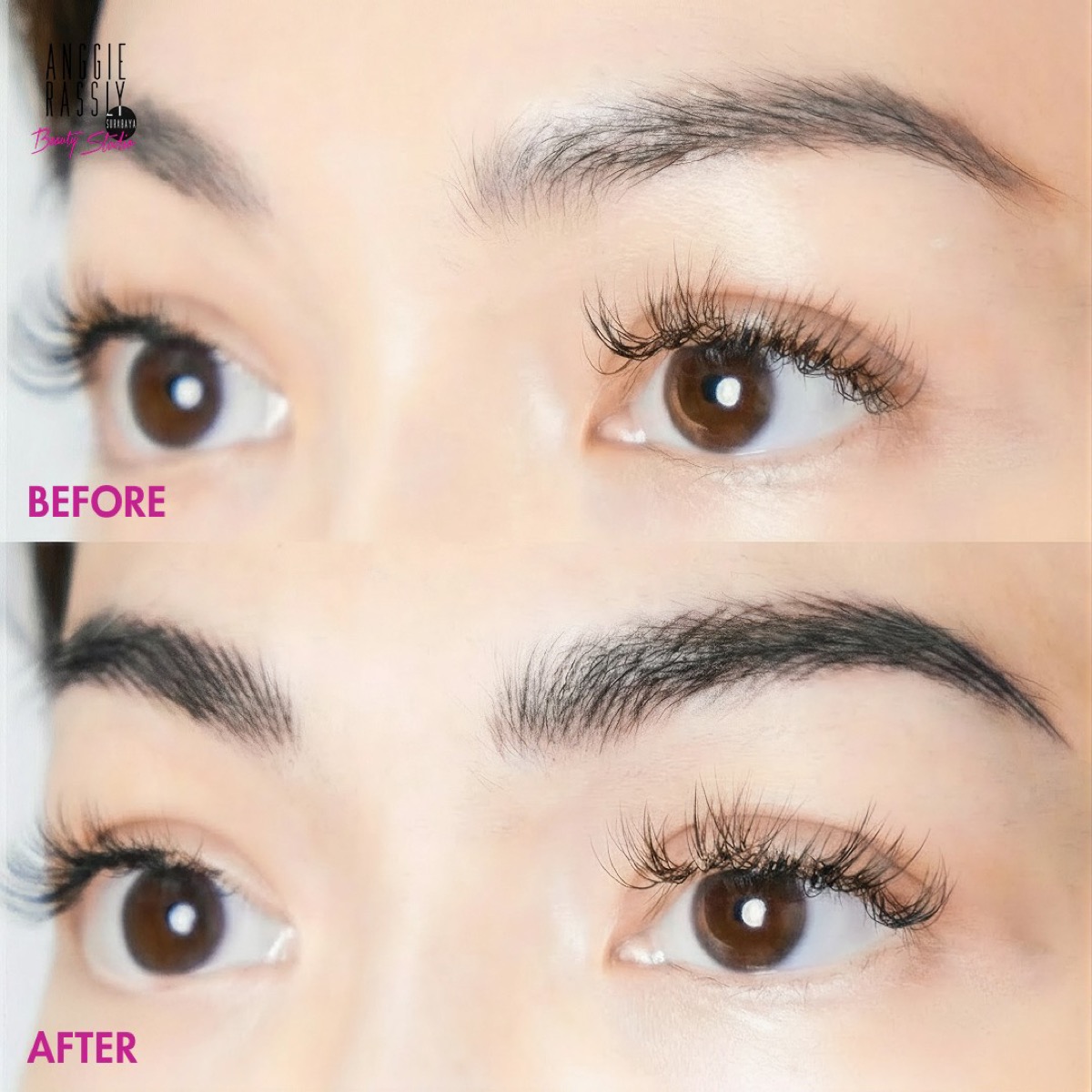 Before after HD Brows Anggie Rassly Surabaya