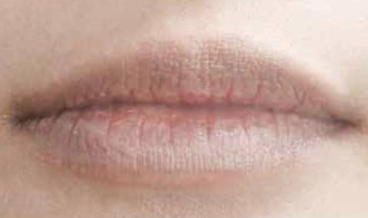 Medium Dark Lips
