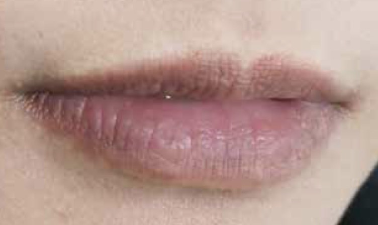Dark Lips