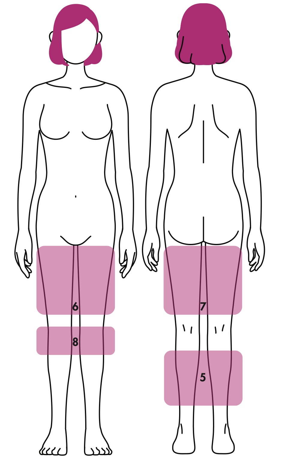 Area treatment stretch mark: Thighs, Calves & Knees